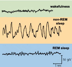 Does experimental paradoxical sleep deprivation (EPSD) is an appropriate  model for evaluation of cardiovascular complications of obstructive sleep  apnea? - Semantic Scholar